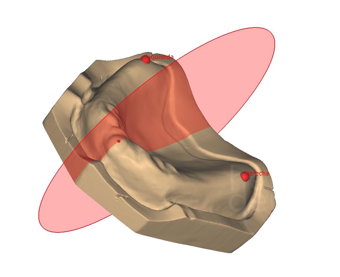 PRÓTESIS COMPLETAS EN CAD-CAM – HelloDent