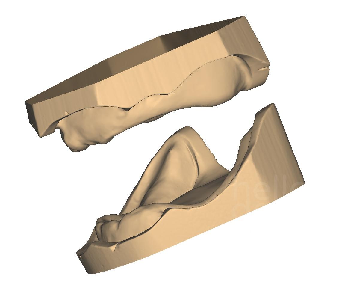 PRÓTESIS COMPLETAS EN CAD-CAM – HelloDent